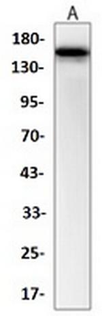 ABCB1 Antibody in Western Blot (WB)