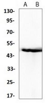 SERPINE1 Recombinant Rabbit Monoclonal Antibody