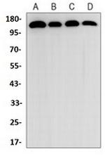 EIF2AK3 Recombinant Rabbit Monoclonal Antibody