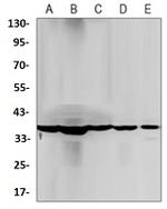 PPP1CB Antibody in Western Blot (WB)