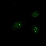 PSEN1 Recombinant Rabbit Monoclonal Antibody