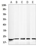 PSEN1 Antibody in Western Blot (WB)