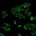 UPF1 Antibody in Immunocytochemistry (ICC/IF)