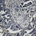 UPF1 Antibody in Immunohistochemistry (Paraffin) (IHC (P))