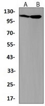 UPF1 Antibody in Western Blot (WB)