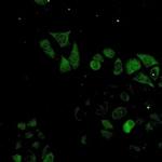 S100A4 Recombinant Rabbit Monoclonal Antibody