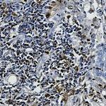 S100A4 Antibody in Immunohistochemistry (Paraffin) (IHC (P))