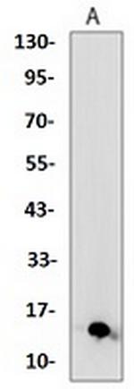 S100A4 Antibody in Western Blot (WB)