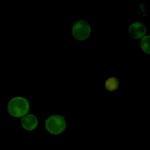 SEMA4D Recombinant Rabbit Monoclonal Antibody