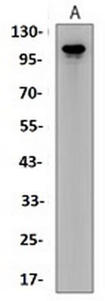 SEMA4D Antibody in Western Blot (WB)