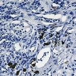SMAD2 Antibody in Immunohistochemistry (Paraffin) (IHC (P))