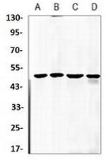 SMAD2 Antibody in Western Blot (WB)