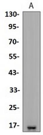 BIRC5 Antibody in Western Blot (WB)