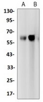 TCF7L2 Antibody in Western Blot (WB)