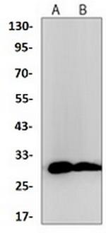 TMEM192 Recombinant Rabbit Monoclonal Antibody