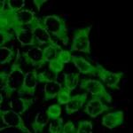 TOMM20 Recombinant Rabbit Monoclonal Antibody