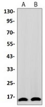 TOMM20 Antibody in Western Blot (WB)
