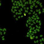 TOP1 Recombinant Rabbit Monoclonal Antibody
