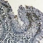 TOP1 Antibody in Immunohistochemistry (Paraffin) (IHC (P))