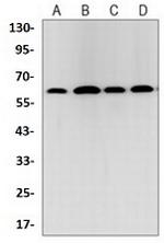 TRAF6 Recombinant Rabbit Monoclonal Antibody