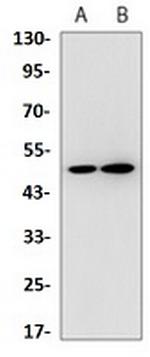 TRIM21 Recombinant Rabbit Monoclonal Antibody