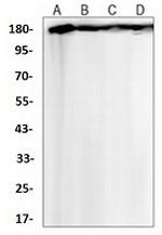 FLT1 Antibody in Western Blot (WB)