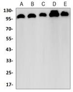 VCL Antibody in Western Blot (WB)