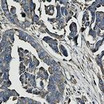 WDR1 Antibody in Immunohistochemistry (Paraffin) (IHC (P))