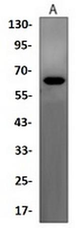WDR1 Antibody in Western Blot (WB)