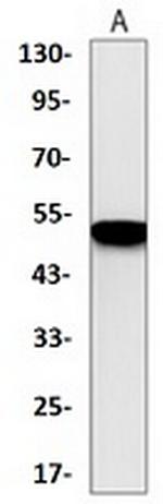 IRF7 Antibody in Western Blot (WB)