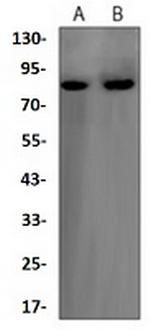 FOXO3 Recombinant Rabbit Monoclonal Antibody