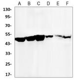 HAVCR1 Recombinant Rabbit Monoclonal Antibody
