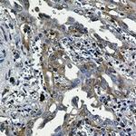 RPS6KA2 Antibody in Immunohistochemistry (Paraffin) (IHC (P))
