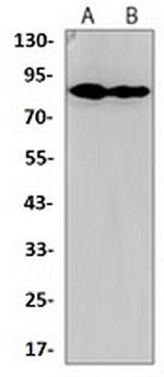 RPS6KA2 Antibody in Western Blot (WB)
