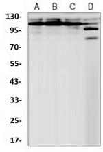 NEDD4 Recombinant Rabbit Monoclonal Antibody