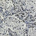 H3K27me3 Antibody in Immunohistochemistry (Paraffin) (IHC (P))
