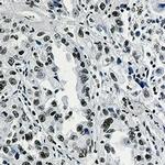 H3K27ac Antibody in Immunohistochemistry (Paraffin) (IHC (P))