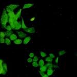 Phospho-EGFR (Tyr1173) Antibody in Immunocytochemistry (ICC/IF)