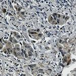 Phospho-EGFR (Tyr1173) Antibody in Immunohistochemistry (Paraffin) (IHC (P))