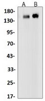Phospho-EGFR (Tyr1173) Antibody in Western Blot (WB)