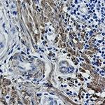 Phospho-FLNB (Ser2152, Ser2107) Antibody in Immunohistochemistry (Paraffin) (IHC (P))