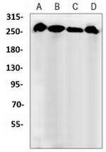 Phospho-FLNB (Ser2152, Ser2107) Antibody in Western Blot (WB)