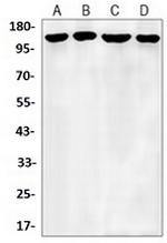 APC Antibody in Western Blot (WB)