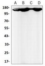 BCR Antibody in Western Blot (WB)