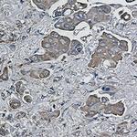 BID Antibody in Immunohistochemistry (Paraffin) (IHC (P))