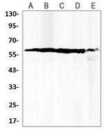 PPP3CA Recombinant Rabbit Monoclonal Antibody