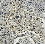 CCT2 Antibody in Immunohistochemistry (Paraffin) (IHC (P))