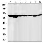 CCT2 Antibody in Western Blot (WB)