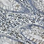 CLSTN1 Antibody in Immunohistochemistry (Paraffin) (IHC (P))