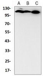CLSTN1 Antibody in Western Blot (WB)